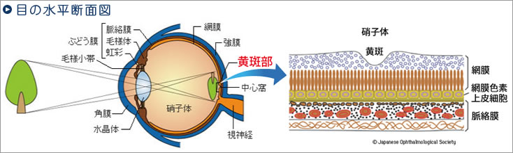 1. 網膜モード