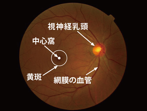 正常眼底