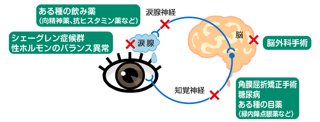 涙の出ない原因