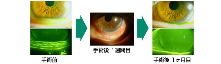 結膜弛緩症